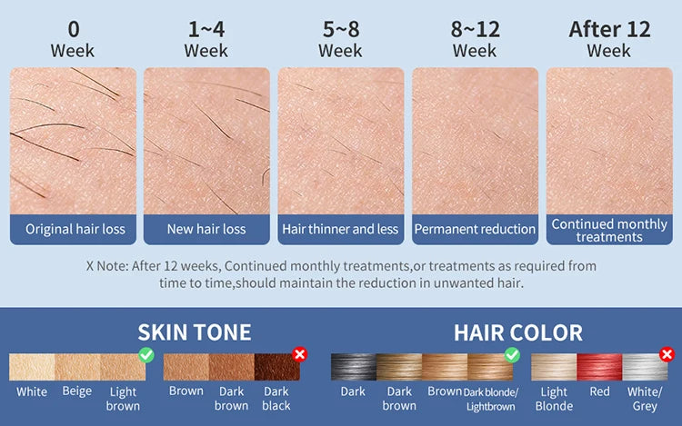 Mlay T18 Ice Cooling IPL Hair Removal Device For Home Use Painless Epilator